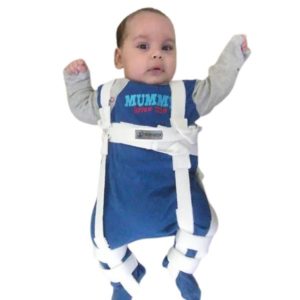 Корективен апарат за исчашени колкови по Павлик